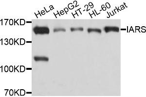 Western blot analysis of extracts of various cell lines, using IARS antibody. (IARS 抗体)