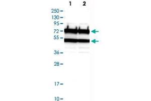 Western Blot analysis of Lane 1: RT-4 and Lane 2: U-251 MG sp cell lysates with CDC16 polyclonal antibody . (CDC16 抗体)