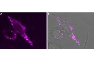 Expression of TRPV3 in rat PC12 cells - Cell surface detection of TRPV3 in intact living rat pheochromocytoma (PC12) cells.