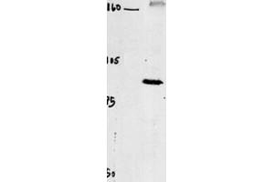 Western Blotting (WB) image for anti-Chloride Channel 4 (CLCN4) antibody (ABIN3002620) (CLCN4 抗体)