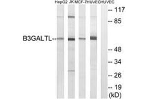 Western blot analysis of extracts from HuvEc/MCF-7/Jurkat/HepG2 cells, using B3GALTL Antibody. (B3GALTL 抗体  (AA 449-498))