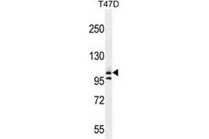 COL1A2 Antibody (N-term) western blot analysis in T47D cell line lysates (35µg/lane). (COL1A2 抗体  (Chain alpha 2, N-Term))