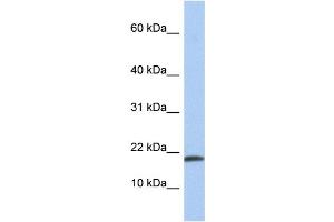 WB Suggested Anti-IL1A Antibody Titration: 0. (IL1A 抗体  (N-Term))