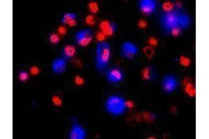 Immunofluorescence (IF) image for anti-Lysosomal-Associated Membrane Protein 2 (LAMP2) antibody (Alexa Fluor 647) (ABIN2657609) (LAMP2 抗体  (Alexa Fluor 647))