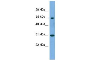 WB Suggested Anti-PNKP Antibody Titration: 0. (PNKP 抗体  (Middle Region))