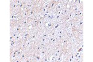 Immunohistochemical staining of human brain tissue using NIPSNAP1 polyclonal antibody  at 2. (NIPSNAP1 抗体  (C-Term))