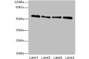 Western blot All lanes: ZNF563 antibody at 7 μg/mL Lane 1: Hela whole cell lysate Lane 2: A549 whole cell lysate Lane 3: MCF-7 whole cell lysate Lane 4: K562 whole cell lysate Secondary Goat polyclonal to rabbit IgG at 1/10000 dilution Predicted band size: 56, 27 kDa Observed band size: 56 kDa (ZNF563 抗体  (AA 214-476))