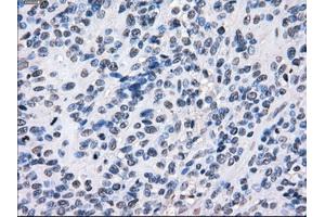 Image no. 10 for anti-Budding Uninhibited By Benzimidazoles 1 Homolog beta (Yeast) (BUB1B) antibody (ABIN1496996) (BUB1B 抗体)