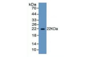 WB of Protein Standard: different control antibodies against Highly purified E. (HMGB1 ELISA 试剂盒)