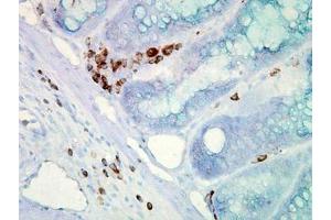 Image no. 2 for anti-Heat Shock Protein 70 (HSP70) (AA 436-503) antibody (ABIN466875) (HSP70 抗体  (AA 436-503))