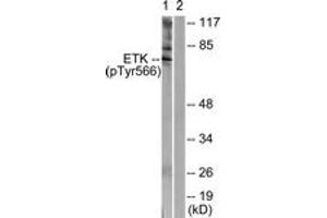 Western blot analysis of extracts from HeLa cells treated with Serum 20% 15', using ETK (Phospho-Tyr566) Antibody. (BMX 抗体  (pTyr566))