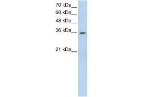 anti-ATP-Binding Cassette, Sub-Family A (ABC1), Member 3 Pseudogene (LOC342293) (N-Term) antibody