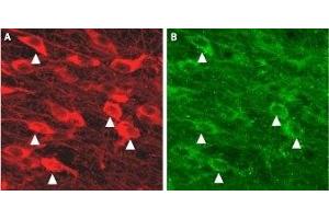 Immunohistochemistry (IHC) image for anti-Small Conductance Calcium-Activated Potassium Channel Protein 3 (KCNN3) (AA 2-21), (Intracellular) antibody (ABIN7043631)