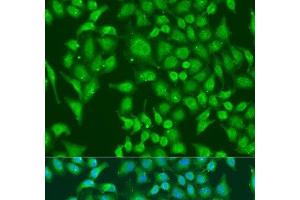 Immunofluorescence analysis of U2OS cells using CENPQ Polyclonal Antibody at dilution of 1:100. (CENPQ 抗体)