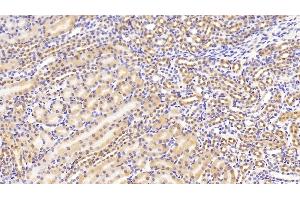 Immunohistochemistry (IHC) image for anti-Non-Metastatic Cells 1, Protein (NM23A) Expressed in (NME1) (AA 6-147) antibody (ABIN7439624)