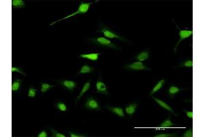 Immunofluorescence of purified MaxPab antibody to ABI2 on HeLa cell. (ABI2 抗体  (AA 1-475))
