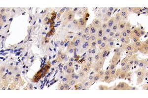 Immunohistochemistry (IHC) image for anti-Keratin 19 (KRT19) (AA 245-391) antibody (ABIN7433303)