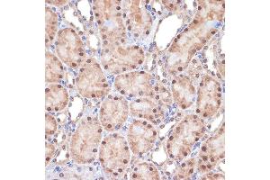Immunohistochemistry of paraffin-embedded rat kidney using Transportin 3 (Transportin 3 (TNPO3)) Rabbit mAb (ABIN7270971) at dilution of 1:100 (40x lens). (Transportin 3 抗体)