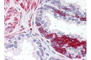 Image no. 1 for anti-ADAM Metallopeptidase Domain 12 (ADAM12) (N-Term) antibody (ABIN372949) (ADAM12 抗体  (N-Term))