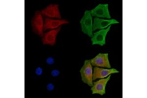 ABIN6258208 and ABIN6273864 staining Hela cells by IF/ICC. (GPR26 抗体  (C-Term))