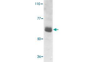 Western blot analysis of IL22RA1 expression in human HepG2 cell lysate with IL22RA1 polyclonal antibody  at 1 ug /mL . (IL22 Receptor alpha 1 抗体  (AA 560-574))
