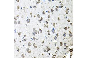 Immunohistochemistry of paraffin-embedded mouse brain using FGF1 antibody. (FGF1 抗体)