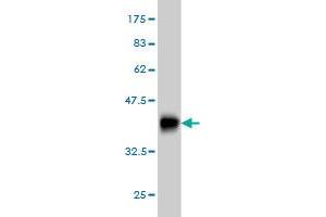 Western Blotting (WB) image for anti-Transient Receptor Potential Cation Channel, Subfamily V, Member 5 (TRPV5) (AA 1-100) antibody (ABIN566023)