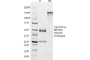 SDS-PAGE Analysis Purified GP2 Mouse Monoclonal Antibody (GP2/1803). (GP2 抗体  (AA 35-179))
