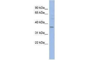 WB Suggested Anti-HMGCLL1 Antibody Titration: 0. (HMGCLL1 抗体  (N-Term))