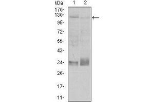 Western blot analysis using ITGB1 mouse mAb against A549 (1), and Jurkat (2) cell lysate. (ITGB1 抗体)