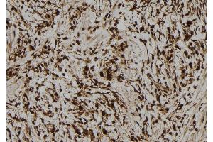 ABIN6278767 at 1/100 staining Human gastric tissue by IHC-P. (LMO7 抗体  (C-Term))