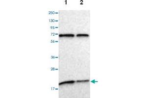 Western blot analysis of Lane 1: Human cell line RT-4, Lane 2: Human cell line U-251MG sp with MDP-1 polyclonal antibody .