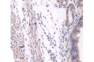 Used in DAB staining on fromalin fixed paraffin- embedded Kidney tissue (NSP5 抗体  (AA 961-1063))