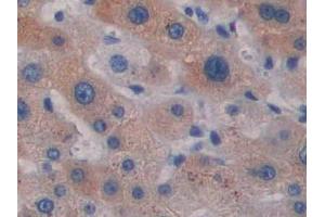 DAB staining on IHC-P; Samples: Simian Liver Tissue (CCL5 抗体  (AA 24-91))