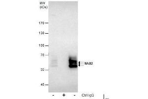 IP Image Immunoprecipitation of NAB2 protein from Jurkat whole cell extracts using 5 μg of NAB2 antibody, Western blot analysis was performed using NAB2 antibody, EasyBlot anti-Rabbit IgG  was used as a secondary reagent. (NAB2 抗体)