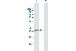Western Blot analysis of RAB13 expression in transfected 293T cell line by RAB13 MaxPab polyclonal antibody. (RAB13 抗体  (AA 1-203))