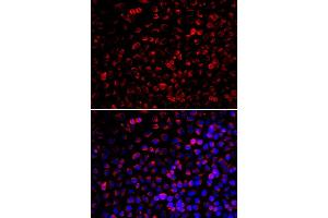 Immunofluorescence analysis of U20S cell using ENOX2 antibody. (ENOX2 抗体)