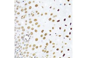 Immunohistochemistry of paraffin-embedded human esophagus using SSB antibody at dilution of 1:100 (40x lens). (SSB 抗体)