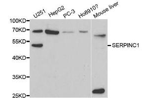 Western blot analysis of extracts of various cell lines, using SERPINC1 antibody. (SERPINC1 抗体  (AA 33-185))
