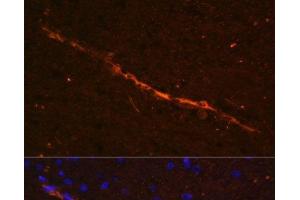 Immunofluorescence analysis of Rat brain using CD34 Polyclonal Antibody at dilution of 1:100. (CD34 抗体)