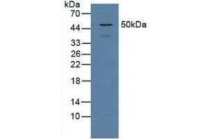 Detection of PSMD5 in Human Jurkat Cells using Polyclonal Antibody to Proteasome 26S Subunit, Non ATPase 5 (PSMD5) (Proteasome 26S Subunit, Non ATPase 5 (AA 143-341) 抗体)