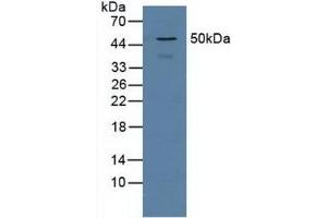 Western Blotting (WB) image for anti-Proteasome (Prosome, Macropain) 26S Subunit, Non-ATPase, 5 (PSMD5) (AA 143-341) antibody (ABIN7443182)