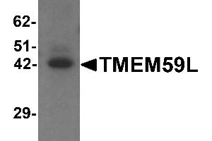 Western blot analysis of TMEM59L in rat heart tissue lysate with TMEM59L antibody at 1 µg/mL.