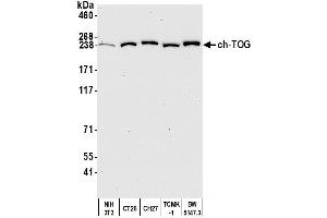 Western Blotting (WB) image for anti-Cytoskeleton Associated Protein 5 (CKAP5) (AA 1425-1475) antibody (ABIN7450110) (CKAP5 抗体  (AA 1425-1475))
