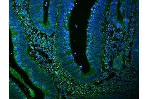 anti-Filamin A, alpha (FLNA) (AA 451-638) antibody