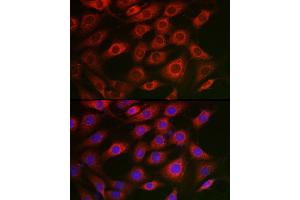 Immunofluorescence analysis of NIH/3T3 cells using Syntrophin alpha 1 Rabbit pAb (ABIN7270692) at dilution of 1:50 (40x lens). (SNTA1 抗体)