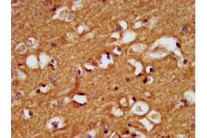 IHC image of ABIN7157473 diluted at 1:500 and staining in paraffin-embedded human brain tissue performed on a Leica BondTM system. (CRYM 抗体  (AA 169-258))
