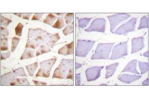 Immunohistochemistry analysis of paraffin-embedded human skeletal muscle tissue, using Actin-pan ( alpha/gamma)  (Ab-55/53) Antibody. (Actin 抗体  (AA 21-70))