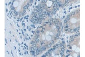 Detection of AK2 in Rat Colon Tissue using Polyclonal Antibody to Adenylate Kinase 2 (AK2) (Adenylate Kinase 2 抗体  (AA 64-232))