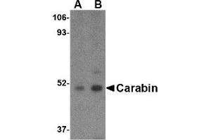 Image no. 1 for anti-TBC1 Domain Family, Member 10C (TBC1D10C) (C-Term) antibody (ABIN490812) (Carabin 抗体  (C-Term))